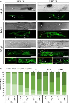 Phosphate accumulation in rice leaves promotes fungal pathogenicity and represses host immune responses during pathogen infection